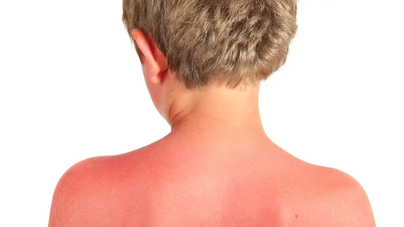 Foto Shutterstock