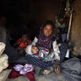 No Yemen, mais de 34 milhões de pessoas precisam de ajuda humanitária para sobreviver, entre os quais, milhões de crianças.