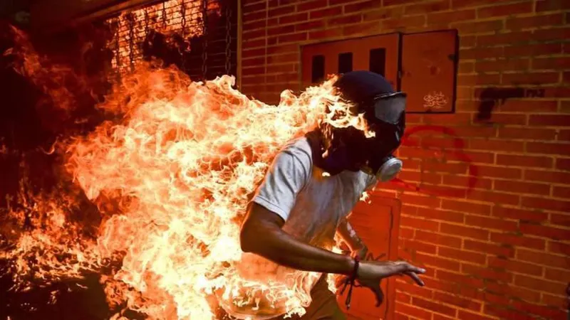A foto vencedora da edição deste ano, de um rapaz em chamas na Venezuela e outras imagens distinguidas no concurso.